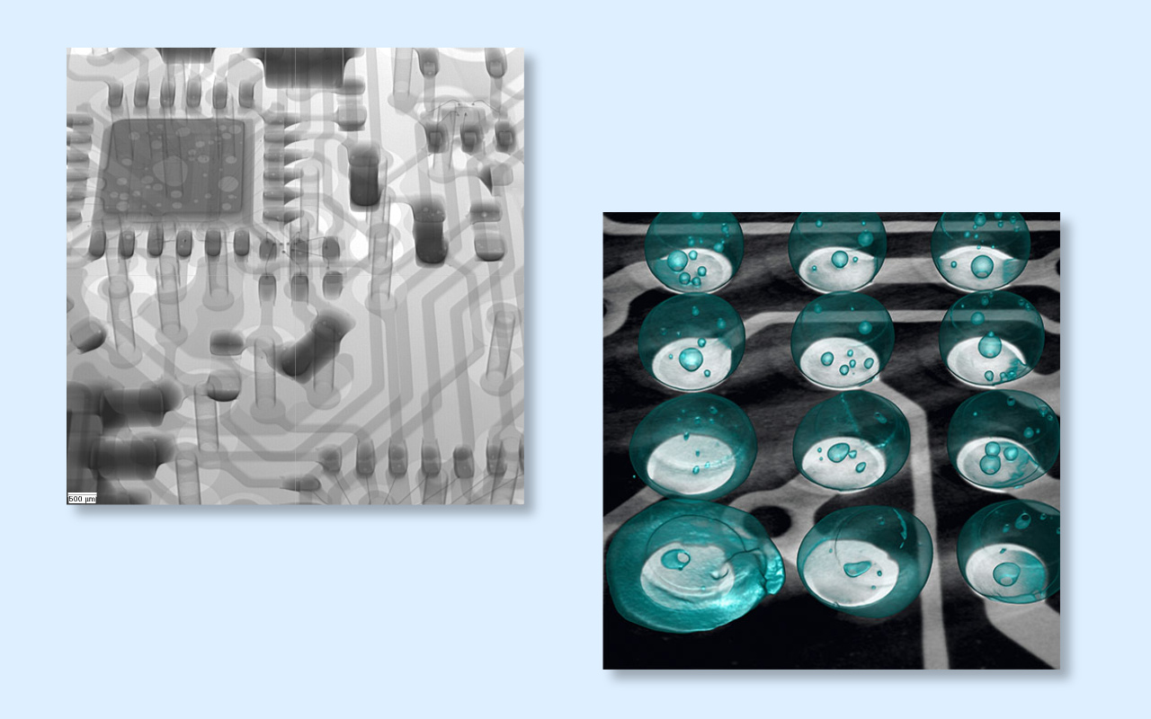 4. 2D vs 3D CT X-ray Which One Do You Really Need? 4. 2D ve 3D CT Röntgeni Gerçekten Hangisine İhtiyacınız Var?