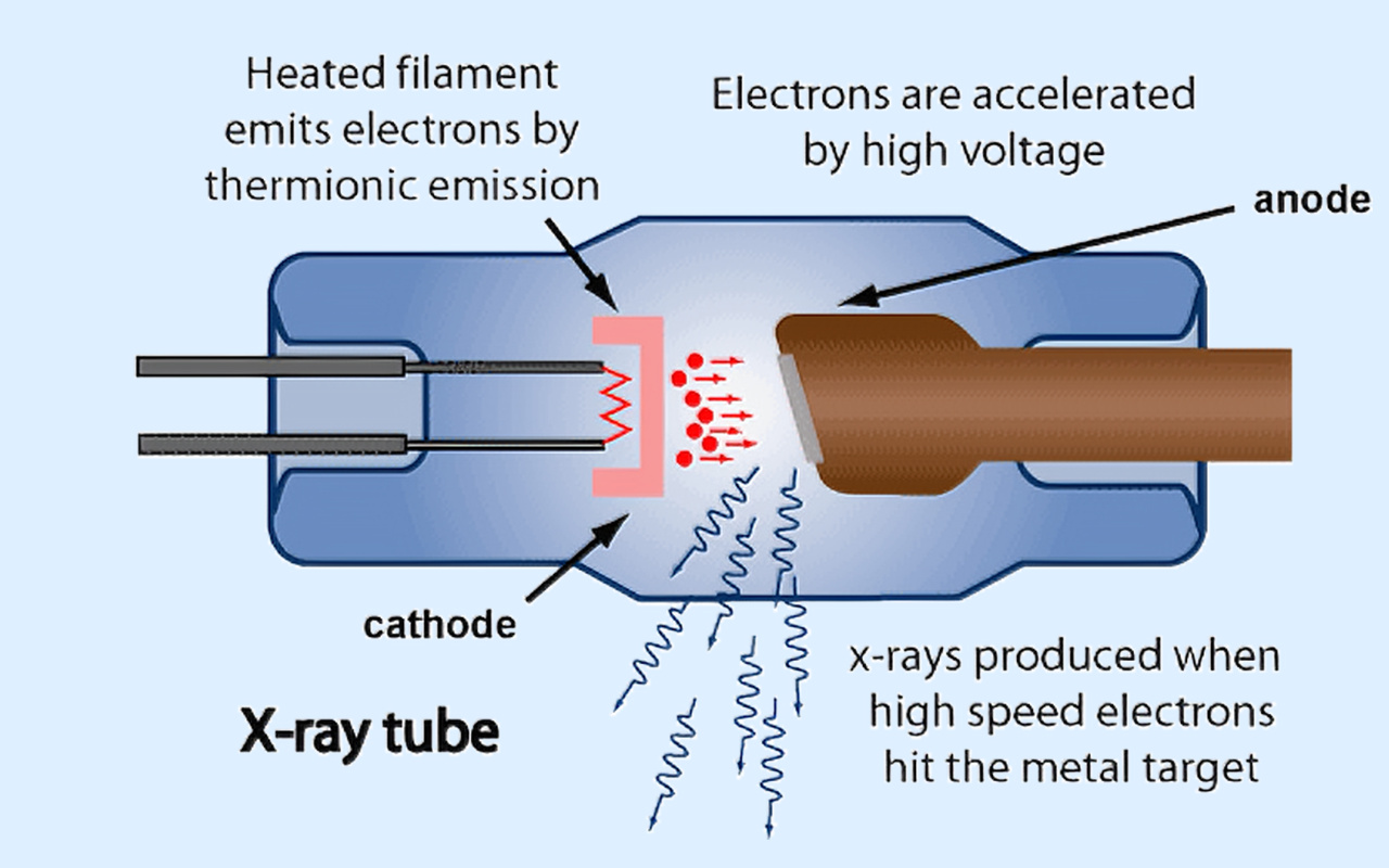 2. What X-ray Technology Actually Does 2. X-ışını Teknolojisi Gerçekte Ne Yapar?